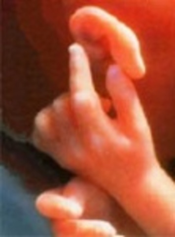 Week Thirty One: Baby detects light