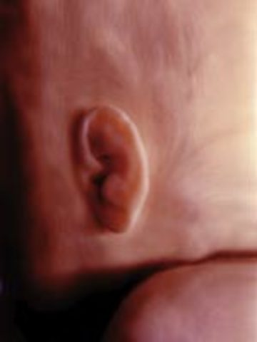 Week 23 Balance Sensory