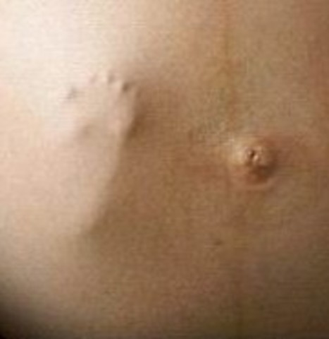 Week Thirty Seven: Pregnancy is Considered 'At Term'