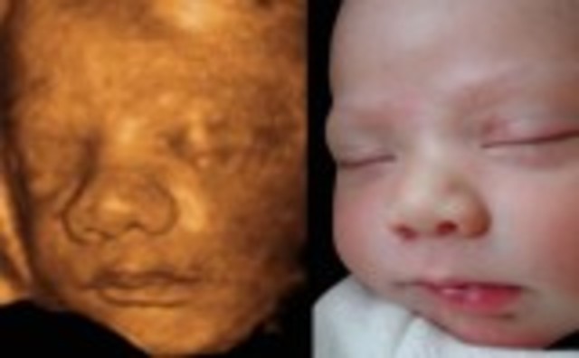 Week Twenty Seven: Eyes Can Open