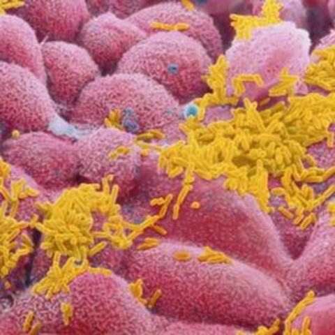 Haemophilius Influenzae