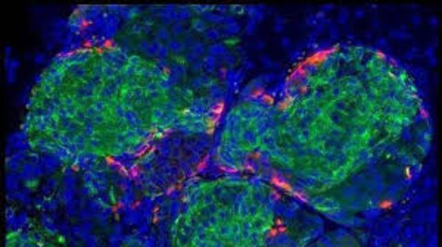 PRIMEROS PERIODOS - ASIRIA
