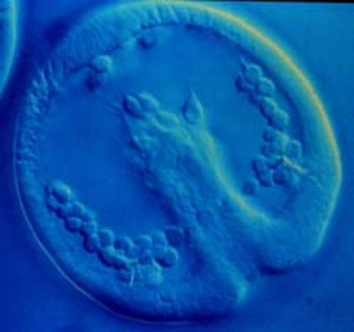 Gastrulación- DÍA 15