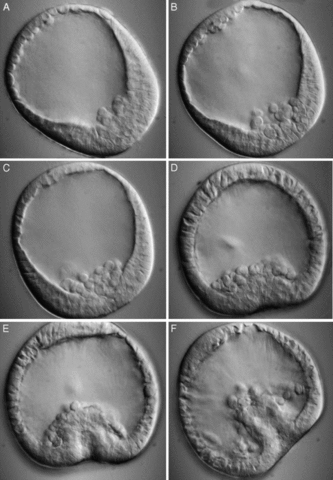 Gástrula triblástica (propia de animales celomados y deuterostomados, como es el ser humano)