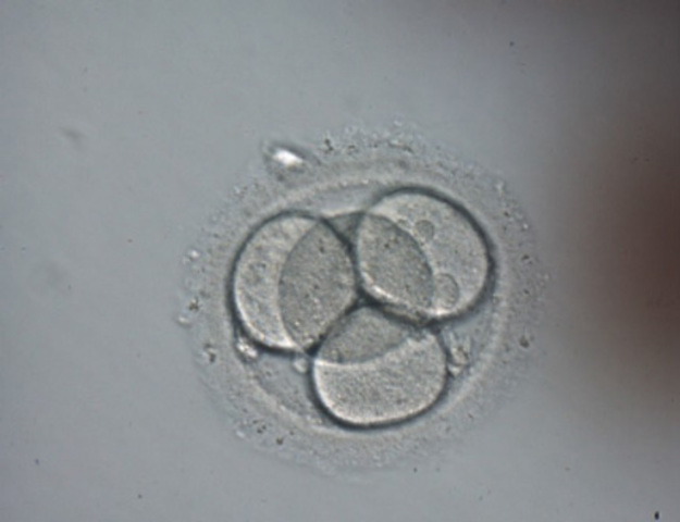 SEGMENTACIÓN (SEGUNDO DÍA)