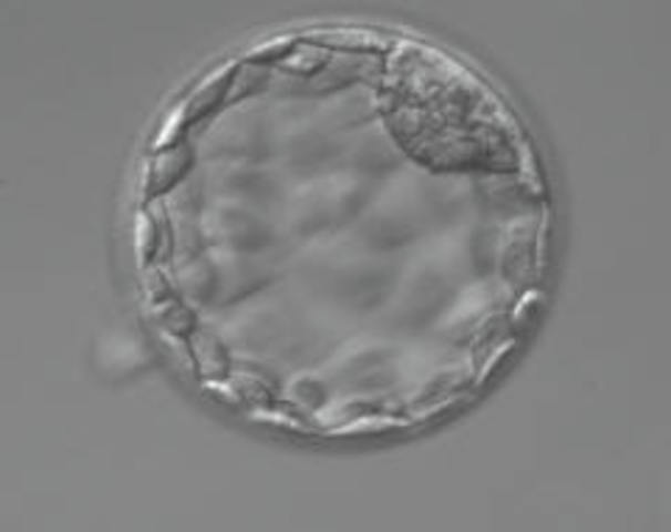 SEGMENTACIÓN (QUINTO DÍA)