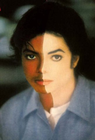 diagnosticó vitíligo