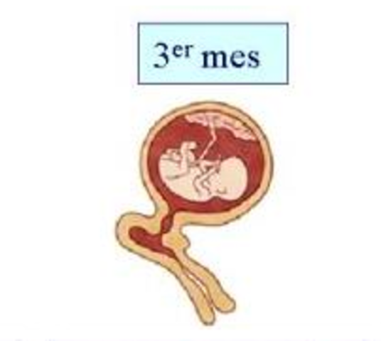 Gestación (1er trimestre)
