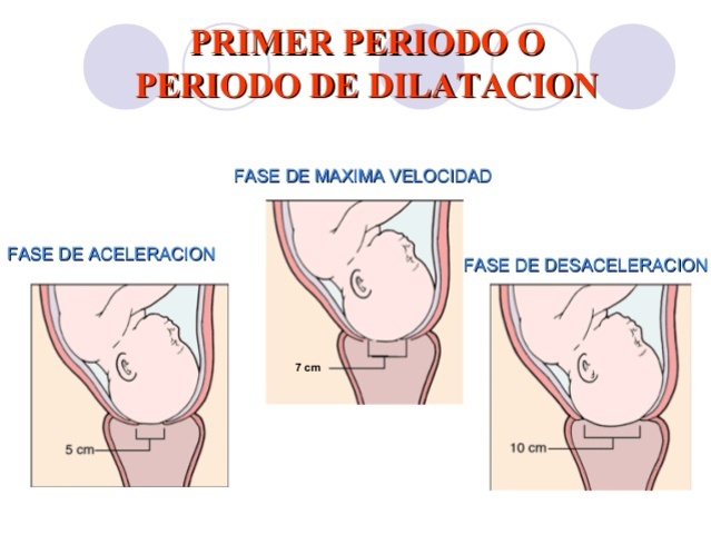 Fase de dilatación