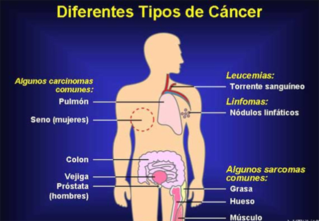 Tipos de cáncer