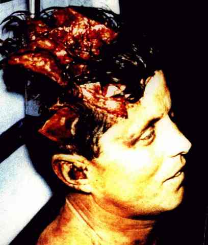 Kennedy Assassination