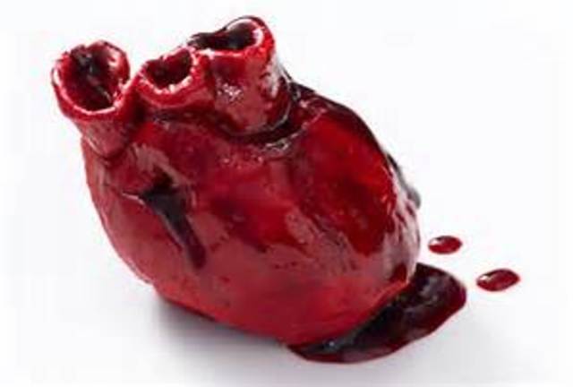 Que Francia no se entere...