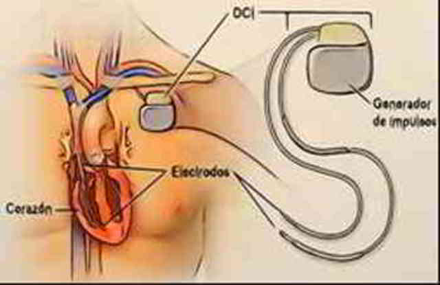 Electrónica implantable