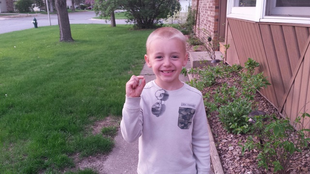 Drew hat seinen Zahn verloren.