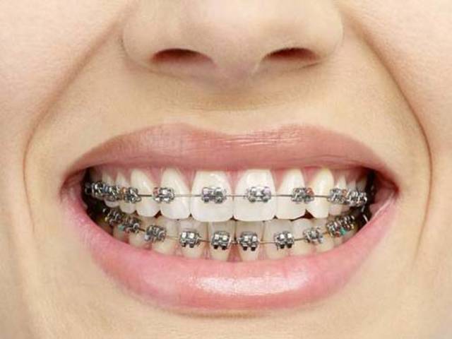 Brackets