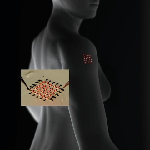 Electronica implantable