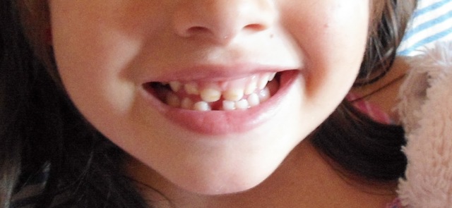 SE CAE MI PRIMER DIENTE