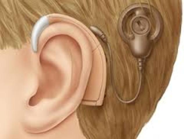 implantes electronicos