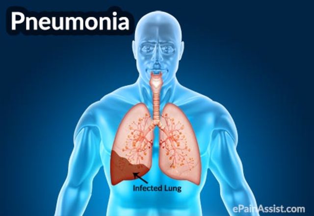 Lewis's father died.