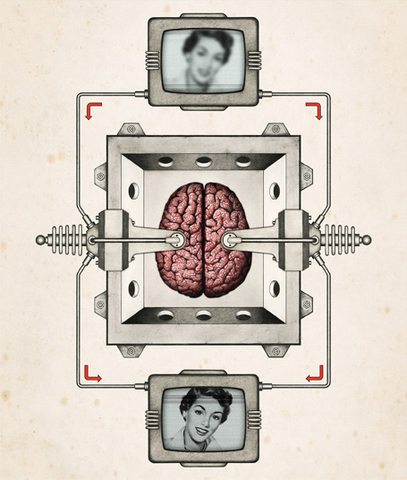 Implantes de memoria