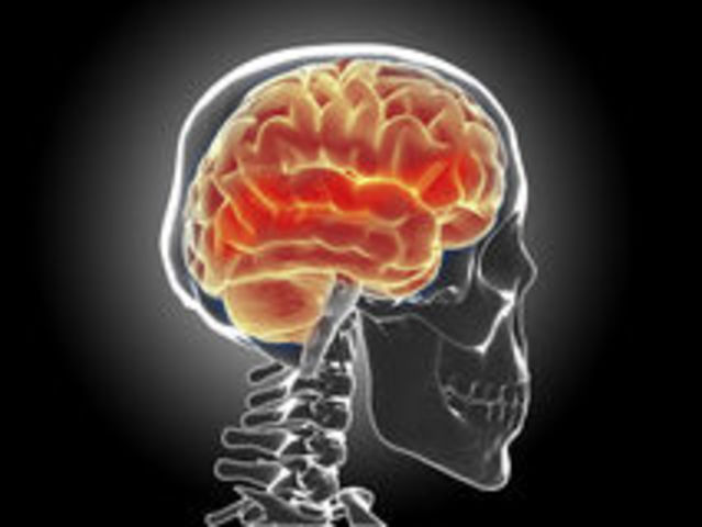 Implantes craneocefalicos