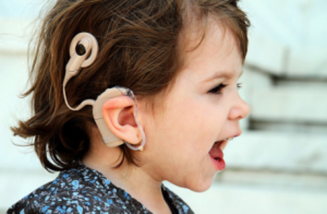 Present Day Cochlear Implants