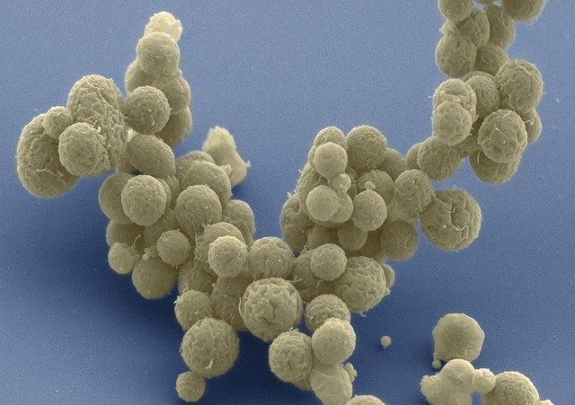 La primera célula sintetica