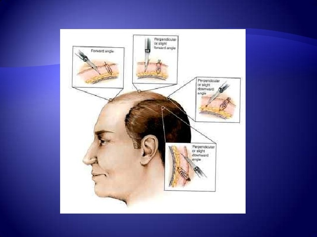 2011 células sintéticas