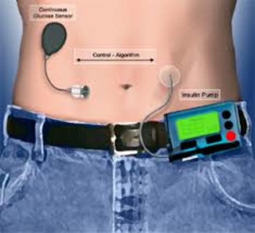 Se inventó la pompa “fluidsense”