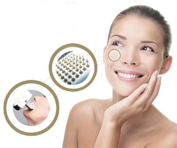 Radio frecuencia tripolar