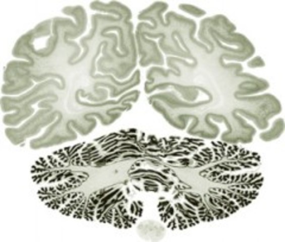 Un atlas del cerebro