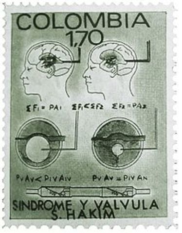 LA VÁLVULA DE HAKIM: TECNOLOGÍA COLOMBIANA PARA TRATAR LA HIDROCEFALIA