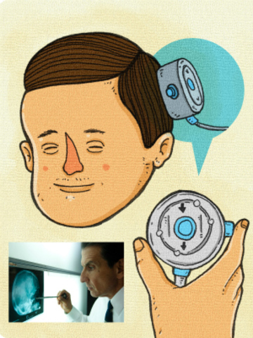 LA VÁLVULA DE HAKIM: TECNOLOGÍA COLOMBIANA PARA TRATAR LA HIDROCEFALIA