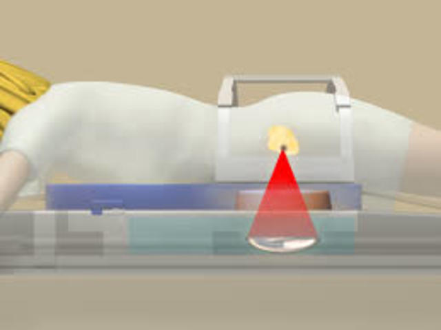 ULTRASONIDO ENFOCADO