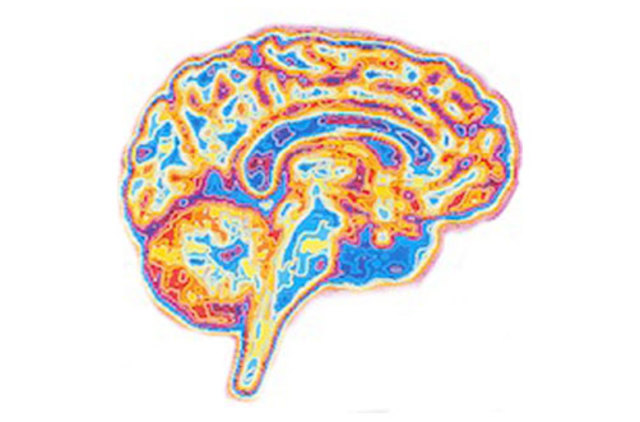 Un atlas del cerebro