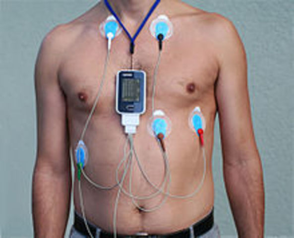 ELECTROCARDIÓGRAFO