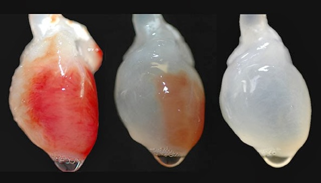 Órganos artificiales