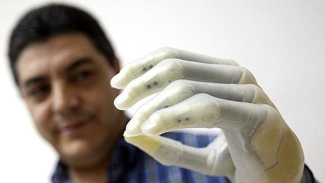 implante de mano