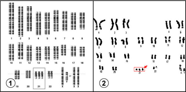 El proyecto genoma humano