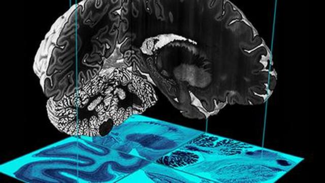 Un atlas del cerebro