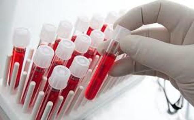 Biopsia líquida contra el cáncer.