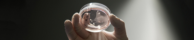 Organoides cerebrales para desentrañar la mente.