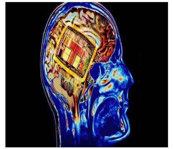 Chips neuromórficos