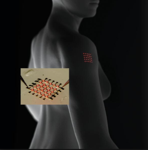 Electrónica implantable