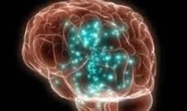 tecnologia neurofomogica