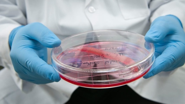 Ingeniería De Células Madres