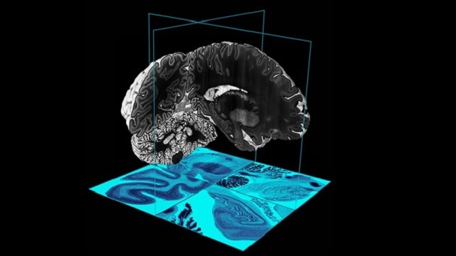 Un atlas del cerebro