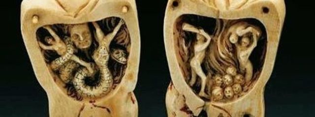 What People Believed Tooth Decay was