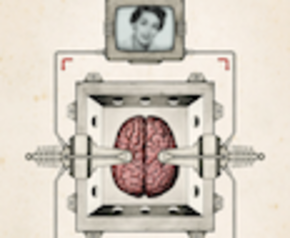 Implantes de memoria