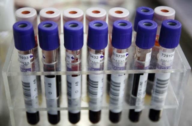 France Ending Ban on Gay Blood Donors